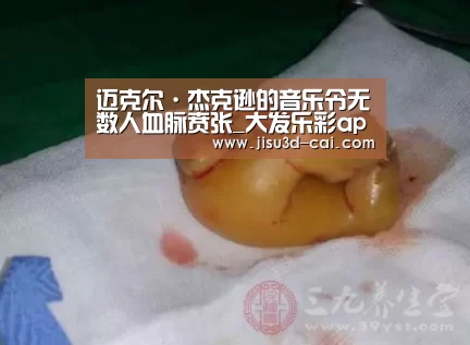 迈克尔·杰克逊的音乐令无数人血脉贲张_大发乐彩app(图2) 大发乐彩官网